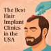 The Best Hair Implant Clinics in the USA bikrisohoj
